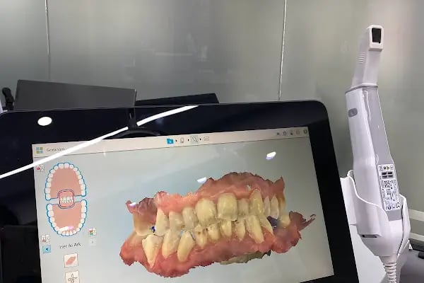 Dentbien Ağız ve Diş Sağlığı Polikliniği / Ataşehir İmplant Diş Kliniği - Resim 4