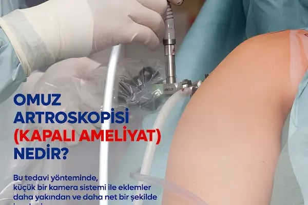 Op. Dr. Ali Varlı - Ortopedi ve Travmatoloji Uzmanı - Resim 3