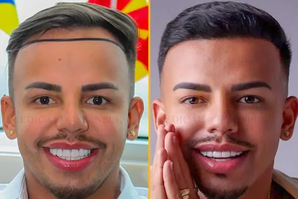 Medical of Istanbul Hospital Hair Transplant | Dental | Aesthetic Treatments - Resim 2