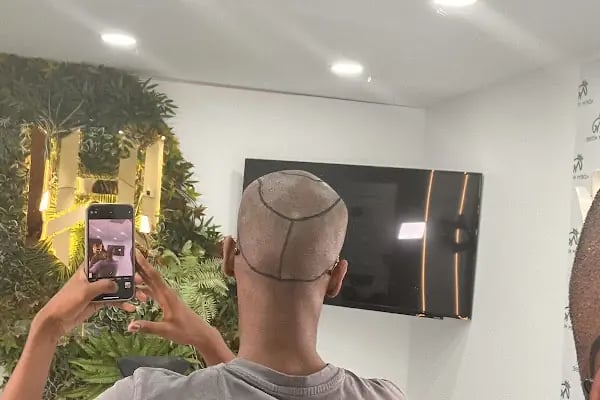 Medical of Istanbul Hospital Hair Transplant | Dental | Aesthetic Treatments - Resim 14