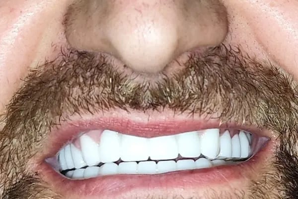 Turadent Ağız ve Diş Sağlığı Merkezi - Resim 4