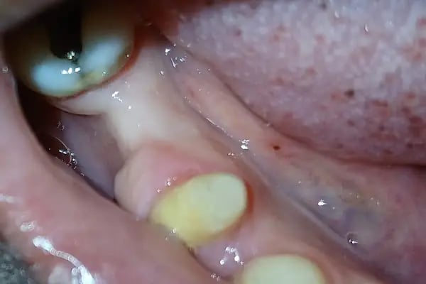 Turadent Ağız ve Diş Sağlığı Merkezi - Resim 12