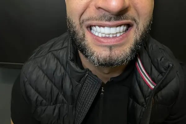 Turadent Ağız ve Diş Sağlığı Merkezi - Resim 6
