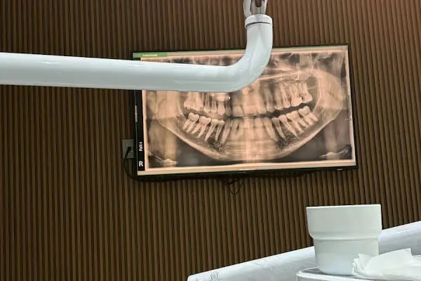 Dentvilla Ağız ve Diş Sağlığı Polikliniği - Resim 9