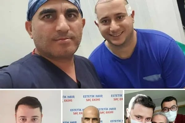 Estetik Hair / Antalya Saç Ekimi - Resim 2