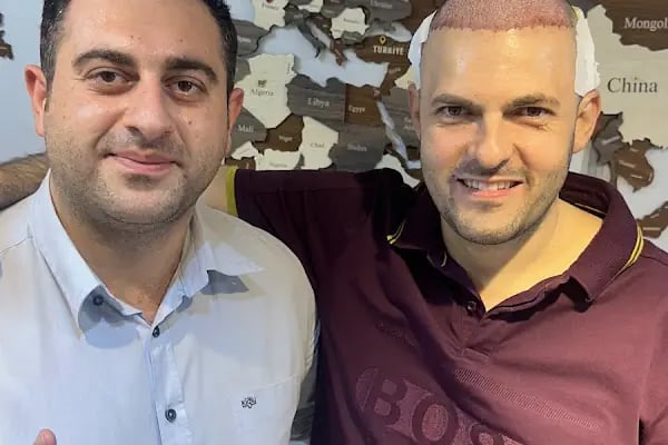 Now Life Clinic - Hair Transplant - Resim 5