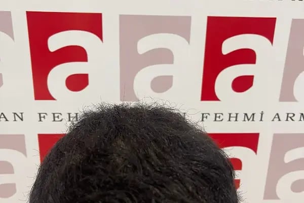 Fehmi ARMAN Health hair Tourism - Resim 14