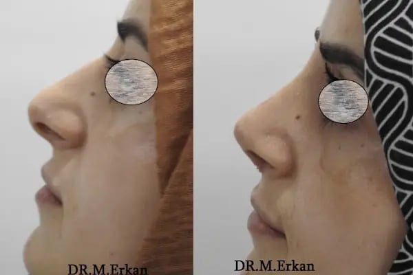 S&amp;U Protez Saçlandırma Merkezi - Resim 16