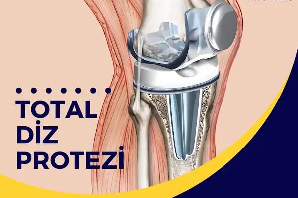 Op. Dr. Ömer Yonga- İstanbul Ortopedi ve Travmatoloji Doktoru - Resim 12