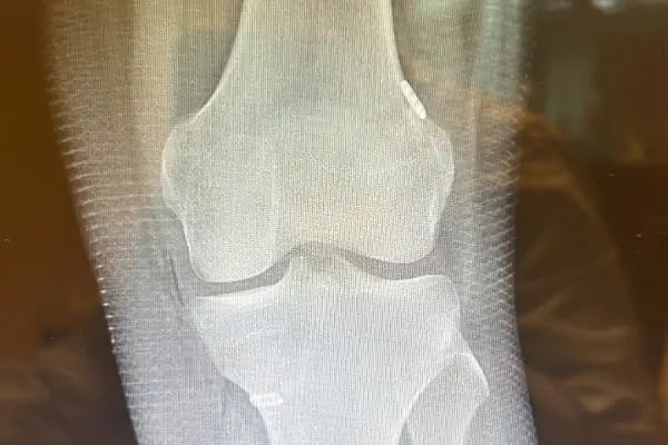 Op. Dr. Ömer Yonga- İstanbul Ortopedi ve Travmatoloji Doktoru - Resim 17