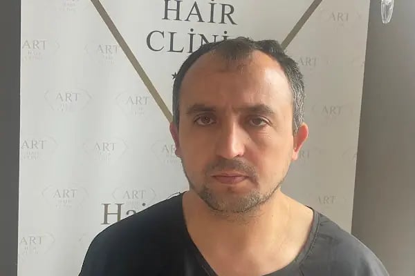 Art Hair Clinic Saç Ekim Merkezi İzmir - En iyi saç ekim merkezi İzmir - Resim 18