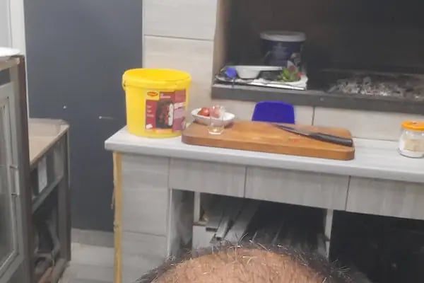 Art Hair Clinic Saç Ekim Merkezi İzmir - En iyi saç ekim merkezi İzmir - Resim 4