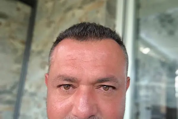Art Hair Clinic Saç Ekim Merkezi İzmir - En iyi saç ekim merkezi İzmir - Resim 17