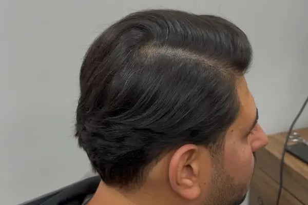 Halit Kurt Barber - Resim 11