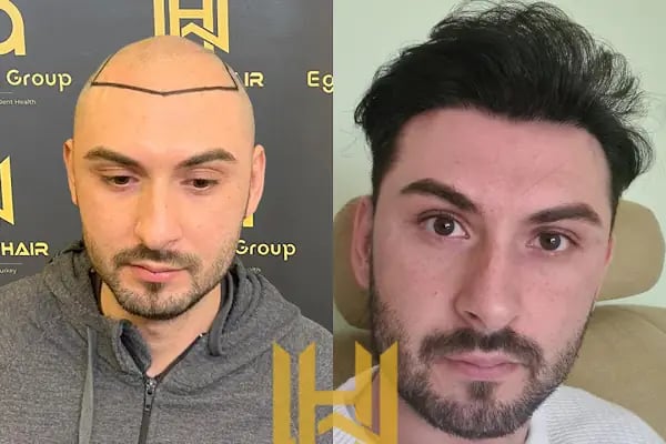 World Of The Hair - Resim 18