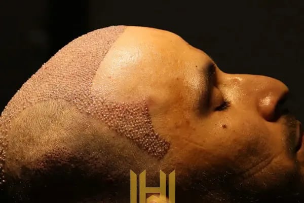 World Of The Hair - Resim 17