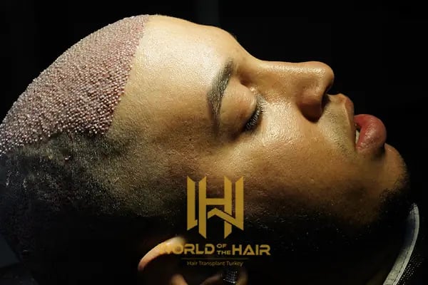 World Of The Hair - Resim 2