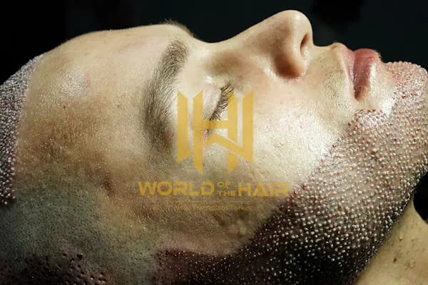 World Of The Hair - Resim 16