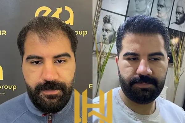World Of The Hair - Resim 12