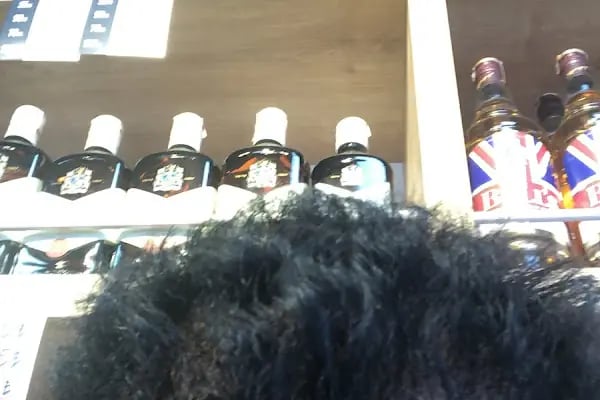 Art Hair Clinic Saç Ekim Merkezi İzmir - En iyi saç ekim merkezi İzmir - Resim 4