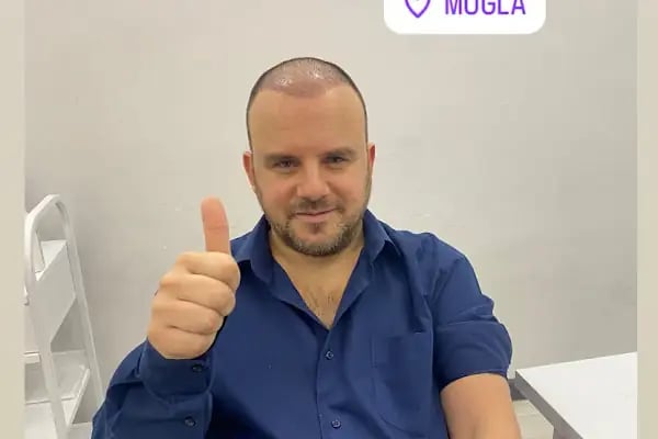 MUĞLA SAÇ EKİM MERKEZİ BÜŞRA CAN SAÇ EKİM MERKEZİ /BÜŞRA CAN HAİR TRANSPLANT - Resim 12