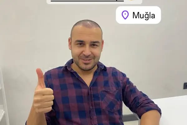 MUĞLA SAÇ EKİM MERKEZİ BÜŞRA CAN SAÇ EKİM MERKEZİ /BÜŞRA CAN HAİR TRANSPLANT - Resim 17