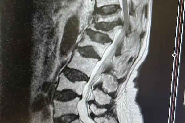 Uzm. Dr. Seval Bayar, Fiziksel Tıp Ve Rehabilitasyon - Resim 7