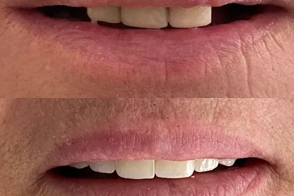 Diş Hekimi Tuğçe ÖZKAN - Elmalı Dent Diş Polikliniği - Resim 13