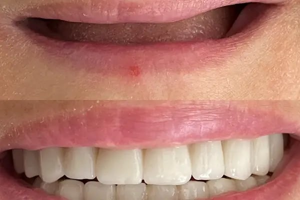 Diş Hekimi Tuğçe ÖZKAN - Elmalı Dent Diş Polikliniği - Resim 14