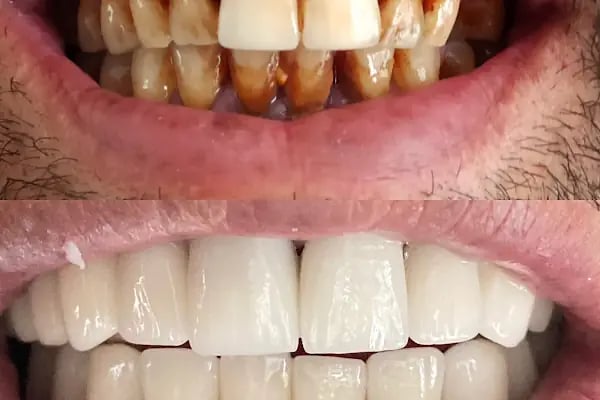Diş Hekimi Tuğçe ÖZKAN - Elmalı Dent Diş Polikliniği - Resim 2