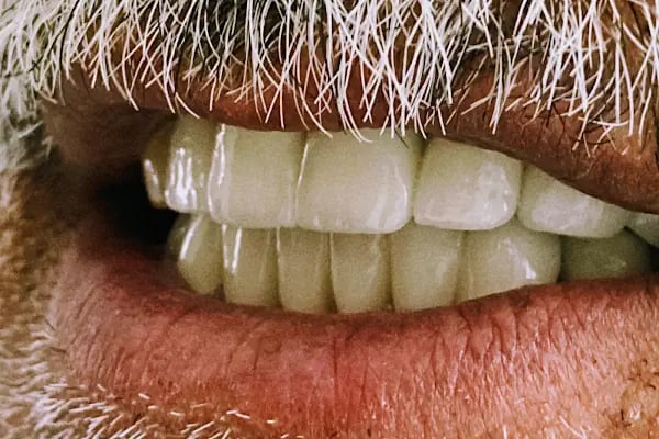 Diş Hekimi Tuğçe ÖZKAN - Elmalı Dent Diş Polikliniği - Resim 4