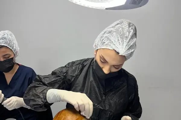 Saç Ekim Merkezi CatchLife | Hair Transplantation Antalya - Resim 20