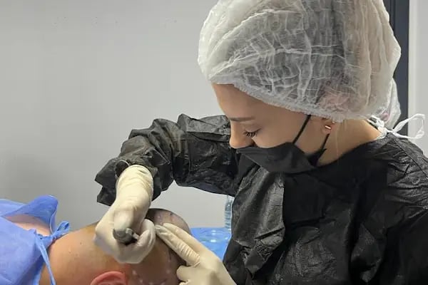 Saç Ekim Merkezi CatchLife | Hair Transplantation Antalya - Resim 18