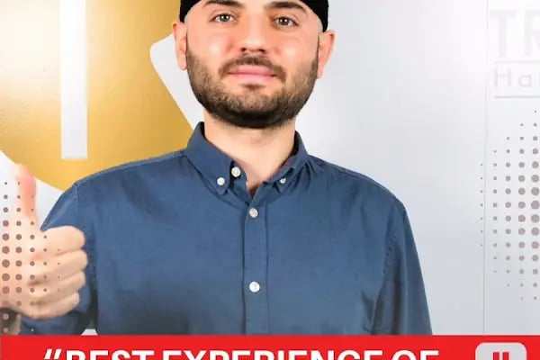 Transes Hair Transplant - Resim 3