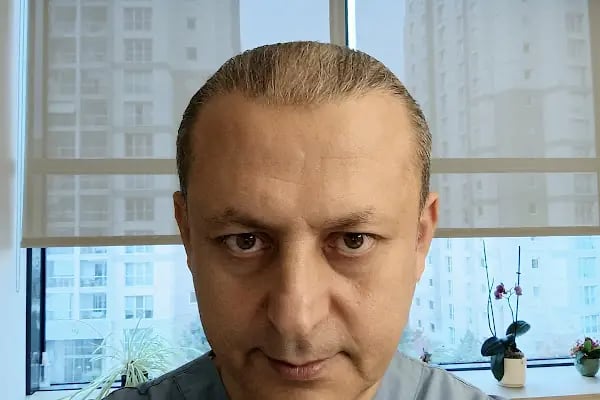 Transes Hair Transplant - Resim 18