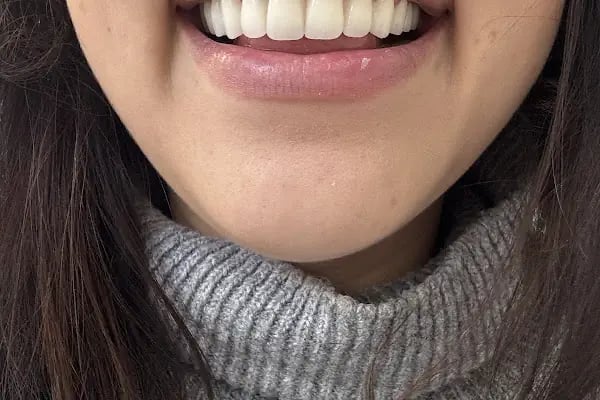 Denta Klinik Ağız ve Diş Sağlığı Polikliniği - Resim 15
