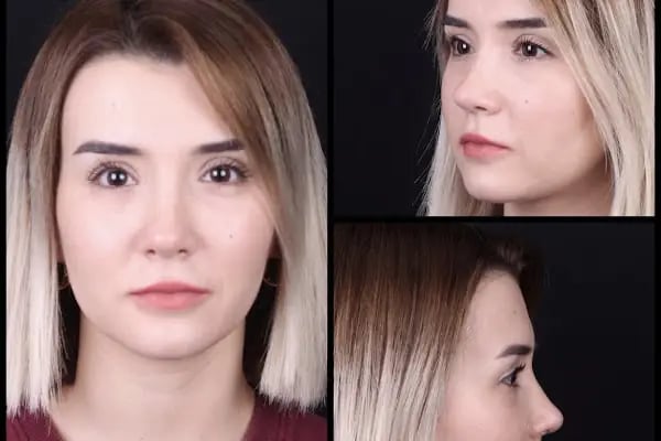 Op. Dr. Engin Selamioğlu Klinik - Resim 10