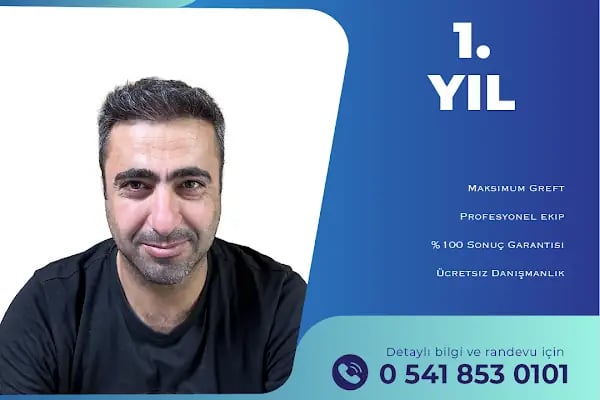 Adana Saç Ekim - Resim 15