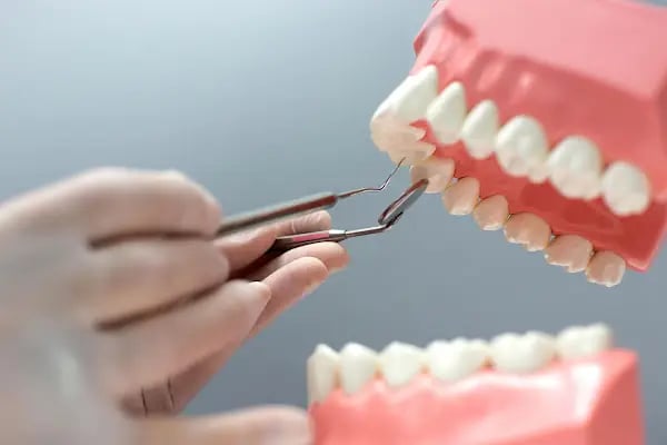 Asudent Kule Ağız ve Diş Sağlığı Polikliniği (Konya Estetik Diş, Konya İmplant, Konya Zirkonyum, Konya Diş Kliniği) - Resim 7