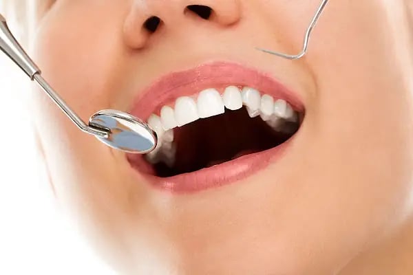 Asudent Kule Ağız ve Diş Sağlığı Polikliniği (Konya Estetik Diş, Konya İmplant, Konya Zirkonyum, Konya Diş Kliniği) - Resim 5