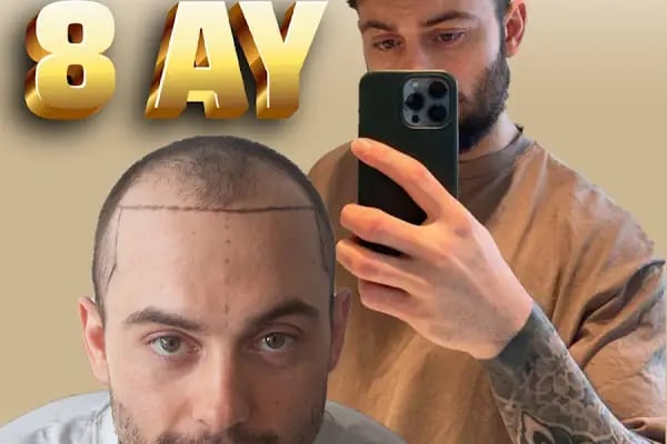 Medeks Hair Center - Resim 18