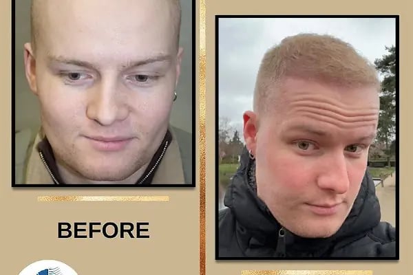 Medeks Hair Center - Resim 19