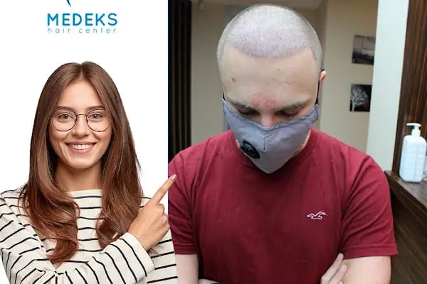 Medeks Hair Center - Resim 13