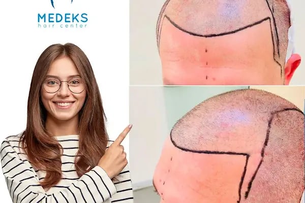 Medeks Hair Center - Resim 16