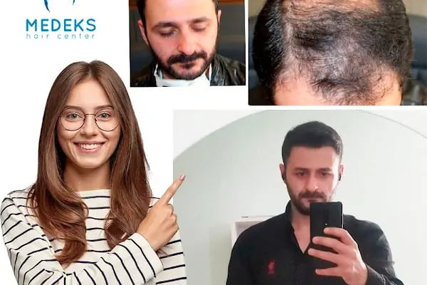 Medeks Hair Center - Resim 14