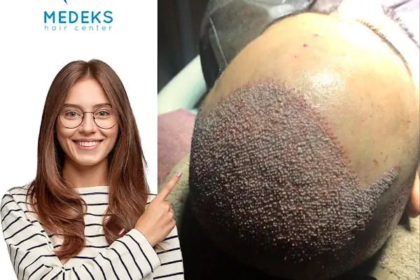 Medeks Hair Center - Resim 15