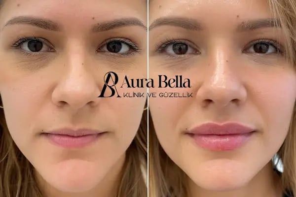 Aura Bella Klinik ve Güzellik Gaziantep - Resim 9