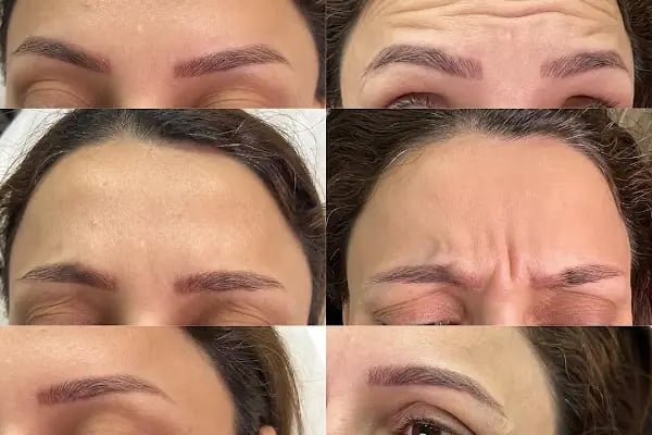Aura Bella Klinik ve Güzellik Gaziantep - Resim 5