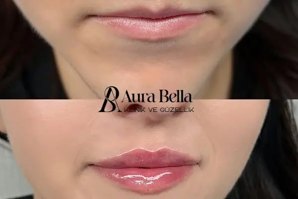 Aura Bella Klinik ve Güzellik Gaziantep - Resim 19