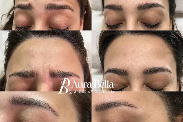Aura Bella Klinik ve Güzellik Gaziantep - Resim 3